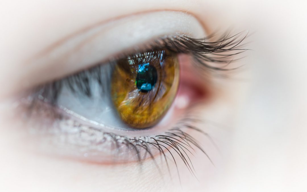 Quels sont les résultats obtenus grâce à ces techniques lasers pour corriger l’astigmatisme ?